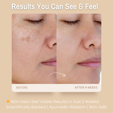 Load image into Gallery viewer, 5% Vitamin C + 5% Niacinamide Brightening Face Cream | Boosts Radiance, Reduces Dark Spots &amp; Evens Skin Tone
