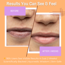Load image into Gallery viewer, 10% Orange + Lemon Lip Scrub &amp; 10% Matcha + Green Tea Lip Mask Balm | Exfoliates &amp; Helps Reduce Dark Lips for a Brighter, Even Tone | 20gm(Pack of 2)