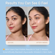 Load image into Gallery viewer, 3% Hyaluronic Acid + 8% Honey Deep Moisturizing Cream | Intensely Hydrates, Locks in Moisture &amp; Nourishes for Soft, Supple Skin