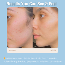 Load image into Gallery viewer, 10% Aloe Vera &amp; Cucumber + 2% Hyaluronic Acid + 2% Vitamin B5 Deep Hydration Face Toner | Intensely Hydrates, Soothes &amp; Refreshes Skin