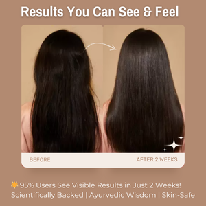 Natural Clarifying & Anti-Dandruff Hair Rinse | With 20% Apple Cider Vinegar | Gently Removes Buildup, Soothes Scalp & Controls Dandruff