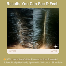 Load image into Gallery viewer, 20% Neem + 10% Kalonji + 5% Moringa Anti-Dandruff &amp; Scalp Care Hair Oil | Reduces dandruff, Soothes scalp irritation &amp; Promotes healthy scalp