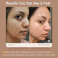 Load image into Gallery viewer, 5% Hyaluronic Acid + 2% Vitamin B5 Ultra-Hydrating Face Serum | with Aloe Vera &amp; Cucumber | Deeply Hydrates for Plump, Soft Skin