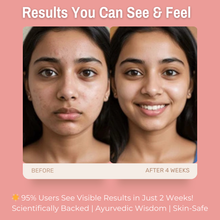Load image into Gallery viewer, 2% Allantoin + 3% Vitamin B5 Sensitive Skin Cream | Soothes, Hydrates &amp; Protects Baby Sensitive Skin