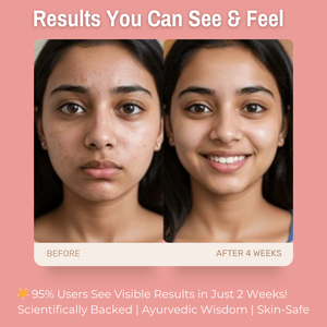 2% Allantoin + 3% Vitamin B5 Sensitive Skin Cream | Soothes, Hydrates & Protects Baby Sensitive Skin