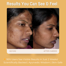 Load image into Gallery viewer, 2% Kojic Acid + 5% Niacinamide Hydrating &amp; Brightening Gel Moisturizer | Reduces Dark Spots &amp; Hyperpigmentation