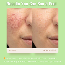Load image into Gallery viewer, 3% Vitamin B5 + 6% Chamomile Soothing &amp; Hydrating Gel Moisturizer | Reduces Redness &amp; Inflammation