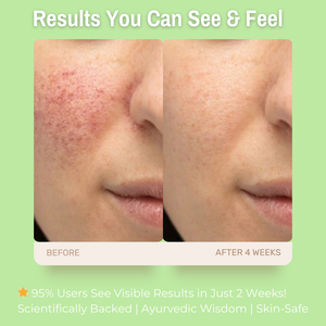3% Vitamin B5 + 6% Chamomile Soothing & Hydrating Gel Moisturizer | Reduces Redness & Inflammation