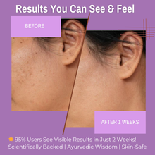 Load image into Gallery viewer, 2% Kojic Acid + 4% Niacinamide Anti-Pigmentation Foaming Face Wash | Fades Dark Spots &amp; Reduces Hyperpigmentation