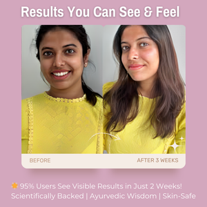 3% Hyaluronic Acid + 2% Vitamin B5 + 10% Calamine Clay HydraPlump Face Pack | Intense Hydration & Skin Plumping