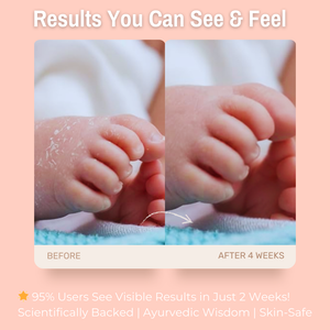 5% Desi Cow A2 Ghee + 1% Allantoin + 4% Coconut Oil Gentle Bliss Baby Body Lotion | Ultra-Gentle Hydration & Protection for Delicate Baby Skin