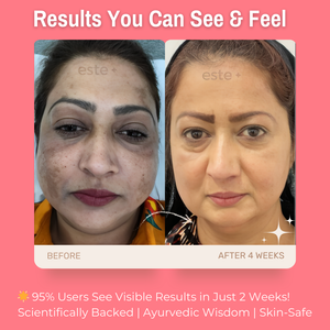 3% Alpha Arbutin + 5% Niacinamide + 10% Kaolin Clay De-Pigmentation Face Pack | Fades Pigmentation & Dark Spots