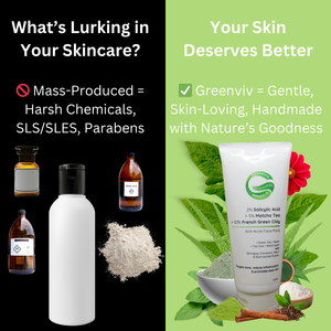 2% Salicylic Acid + 5% Matcha Tea + 10% French Green Clay Anti-Acne Face Pack | Deep Detox & Oil Control
