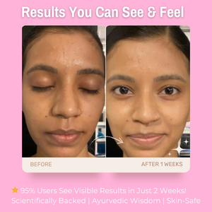 2% Vitamin C + 5% Niacinamide + 10% French Pink Clay Glow & Brightening Face Pack | Deep Cleansing, Evens Skin Tone & Radiance Boost