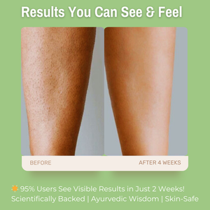 13% Aloe Vera & Honey + 5% Cupuaçu Butter + 4% Argan Oil Smooth & Supple Body Lotion | Deeply Nourishes & Hydrates Dry Skin