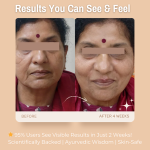 3% Vitamin E & A + 5% Collagen & Pea protein + 10% Multani Mitti Anti-Aging Face Pack | Reduces Wrinkles & Fine Lines