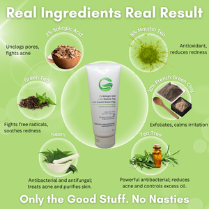 2% Salicylic Acid + 5% Matcha Tea + 10% French Green Clay Anti-Acne Face Pack | Deep Detox & Oil Control