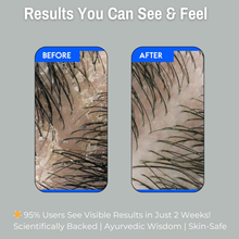 Load image into Gallery viewer, 1% Salicylic Acid + 4% Witch Hazel Scalp Clarifying Foaming Hair Wash | Controls Dandruff, Regulates Oil &amp; Promotes Healthy Scalp