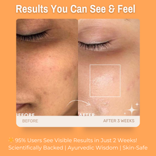 Load image into Gallery viewer, 5% Rice Bran + 1% Lactic Acid + 1% Vitamin C Glowing Skin Face Scrub | Gently Exfoliates, Brightens &amp; smoothens the skin