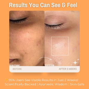 5% Rice Bran + 1% Lactic Acid + 1% Vitamin C Glowing Skin Face Scrub | Gently Exfoliates, Brightens & smoothens the skin