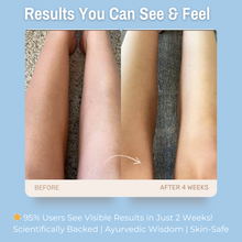 Load image into Gallery viewer, 3% Hyaluronic Acid + 5% Avocado Butter + 4% Squalane Oil Hydro Restore &amp; Calm Body Lotion | Deep Nourishment &amp; Barrier Support for Dry, Sensitive &amp; Eczema-Prone Skin