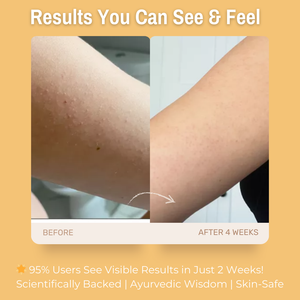 5% Niacinamide + 5% Shea Butter + 4% Almond Oil Hydrating & Soothing Body Lotion | Deeply Moisturizes & Strengthens Skin Barrier