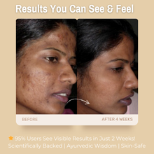 Load image into Gallery viewer, 10% Niacinamide + 2% Kojic Acid De-Pigmentation Face Serum | with Licorice &amp; Lemon | Reduces Dark Spots &amp; Pigmentation, Brightens &amp; Evens Skin Tone