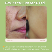 Load image into Gallery viewer, 2% Alpha Arbutin + 1% Kojic Acid + 3% Niacinamide Anti-Pigmentation Face Wash | Helps Reduce Dark Spots, Even Skin Tone &amp; Boost Radiance