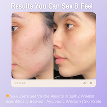 Load image into Gallery viewer, 1% Allantoin + 2% Hyaluronic Acid + 2% Vitamin B5 Hydration Boosting Face Wash | Deep Hydration, Soothing &amp; Redness Care