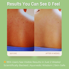 Load image into Gallery viewer, 1% Salicylic Acid + 2% Niacinamide + 4% Tea Tree Clarifying &amp; Acne-Control Body Wash | Clear Bacne, Reduce Redness &amp; Balance Oil