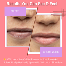 Load image into Gallery viewer, 10% Sandalwood + Rose Lip Scrub &amp; 10% Mango + Turmeric Lip Mask Balm | Repair chapped &amp; Sun-damaged lips | 20gm(Pack of 2)