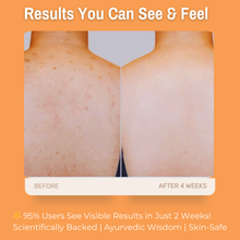 Load image into Gallery viewer, 1% Alpha Arbutin + 2% Vitamin C + 1% Kojic Acid Brightening Body Wash | Fades Dark Spots, Reduces Pigmentation &amp; Evens Skin Tone