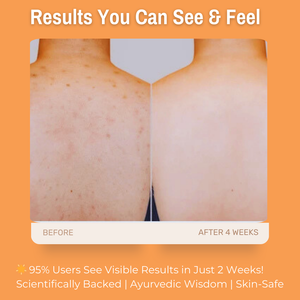 1% Alpha Arbutin + 2% Vitamin C + 1% Kojic Acid Brightening Body Wash | Fades Dark Spots, Reduces Pigmentation & Evens Skin Tone